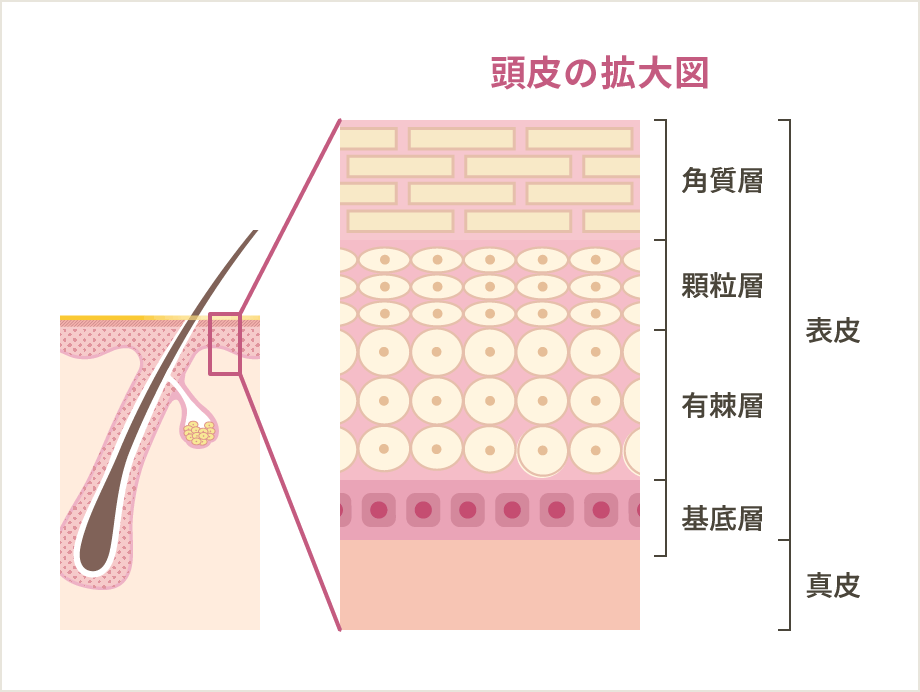 地肌の拡大図