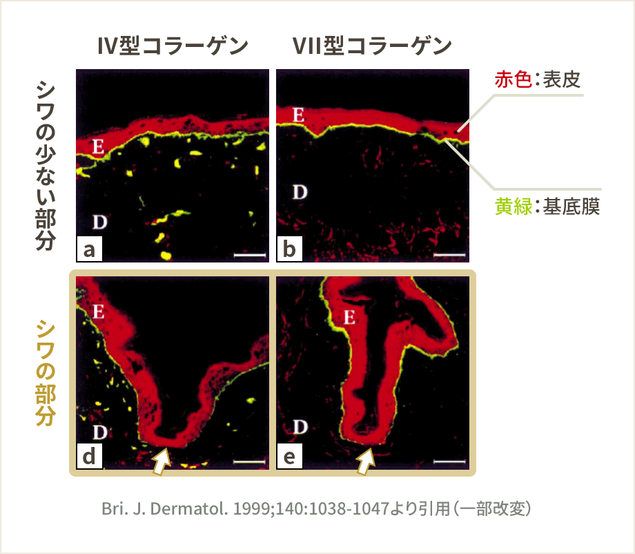 シワと基底膜の関係